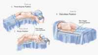 Patient positioning during fat transfer surgery