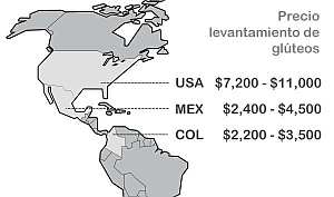Precios de Aumento de Gluteos en USA, Mexico y Colombia
