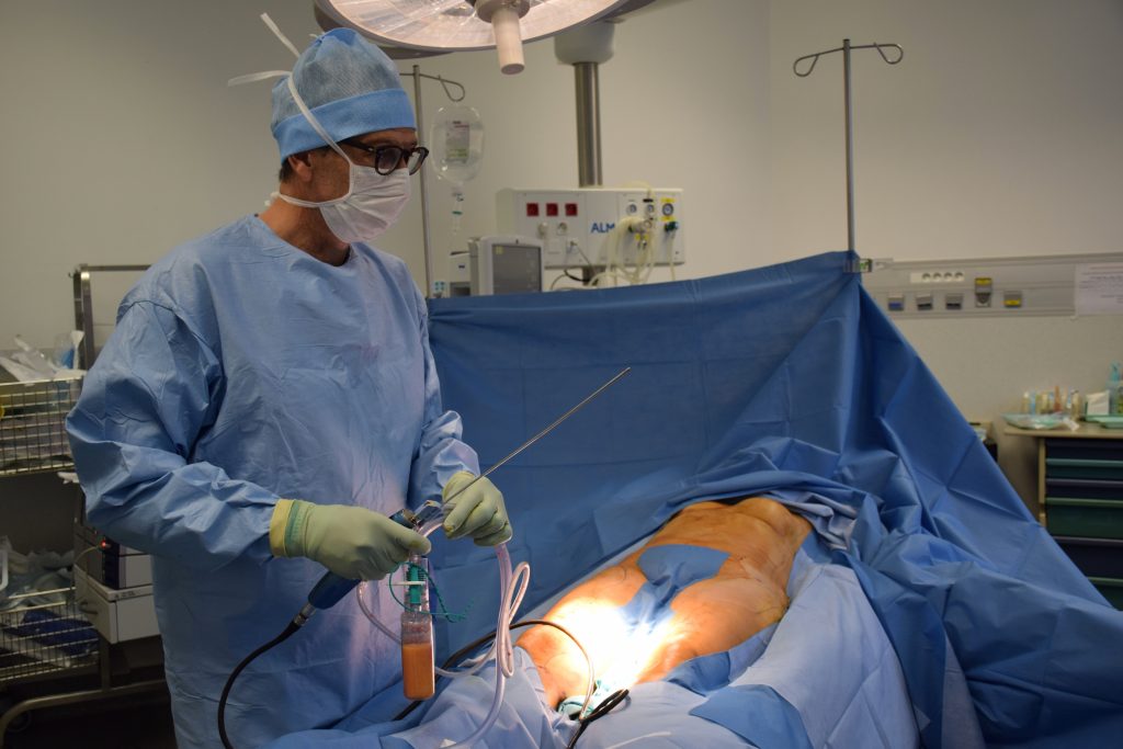 lipo-surgery