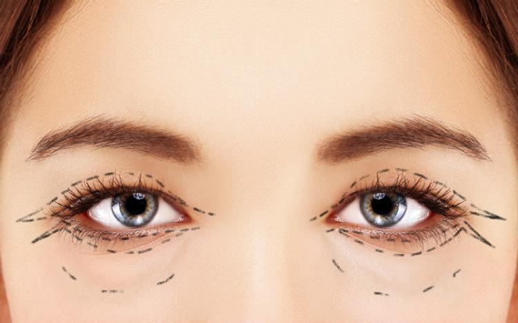 Cosmetic Eyelid Surgery Near Me: A Complete Guide