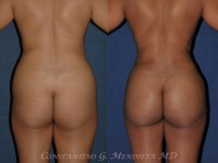 Before & After Photo